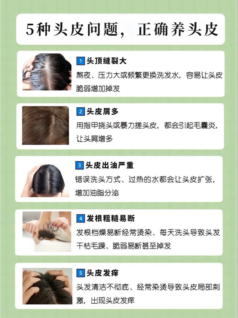 头皮屑多会传染给家人吗？预防头皮屑传染的有效方法是什么？
