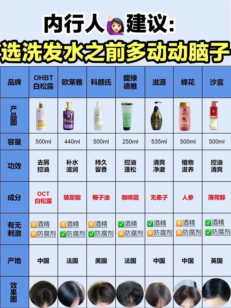 头皮屑多会传染给家人吗？预防头皮屑传染的有效方法是什么？